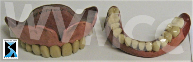 Dentures from WVMCC collections